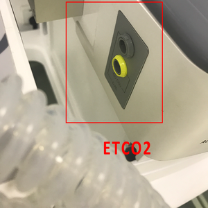 Микропроцессорный контролируемый одновременно монитор ECG Rr аппарат для анестезии для продажи - Product Image 5