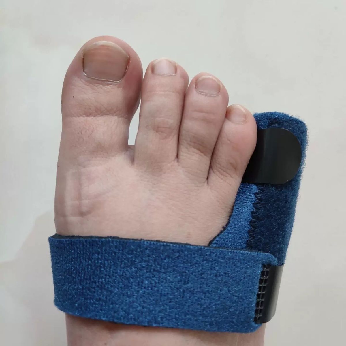 All five toes