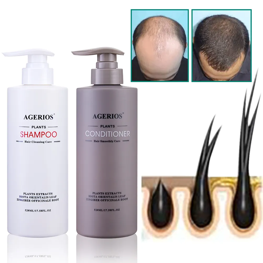 Agerios Natural Anti-Hair Loss Tratamento Peppermint Cabelo Crescimento Shampoo e Condicionador Terapia com Óleos de Alecrim Biotina