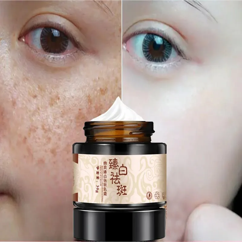 Crema blanqueadora y de eliminación de pecas, 30g, diluye las manchas, manchas de senil, chloasma, crema blanqueadora cr