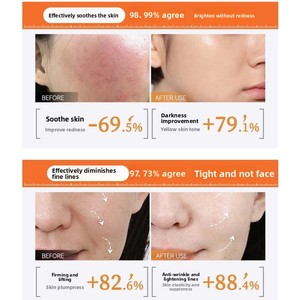 बहु-कोलेजन पेप्टाइड हड्डी चरण तरल, विरोधी-झुर्रियों के लिए परत की हड्डी के चरण तरल - Product Image 4