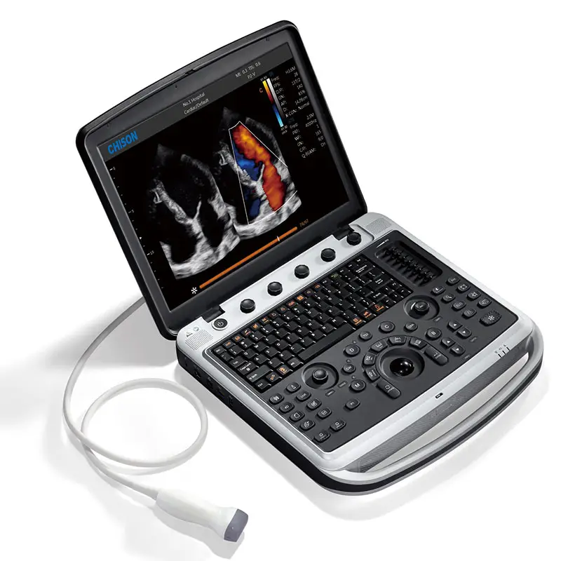 SonoBook9 Smart OB/GYN 4D portátil Color Doppler máquina de ultrasonido Color Doppler sistema con CHISON Virtual