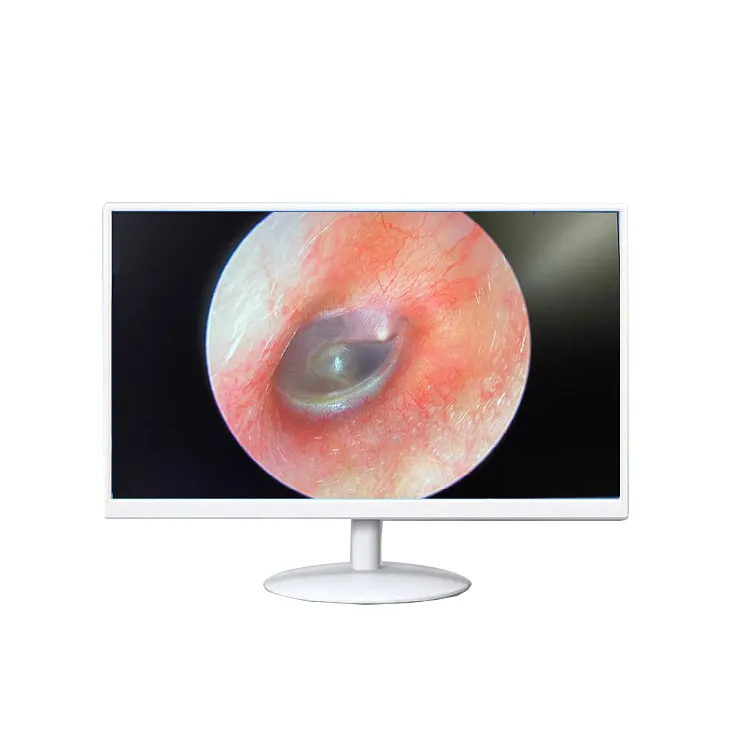 Werks weiß 10,1 13,3 15 17 19 21,5 22 24 27-Zoll-LCD-Monitor Full-HD-Ohr Medizinisches endoskopisches Display Gefrier rahmen monitor