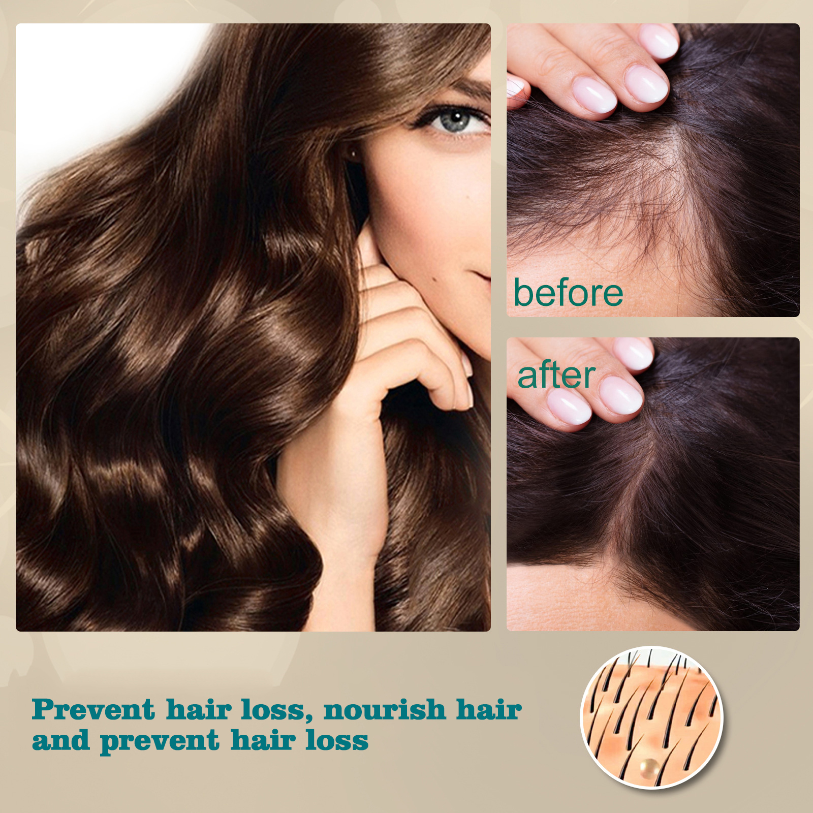 hot sale natural hair loss treatment solution 5 days ginger hair growth ointment 30g hair growth cream