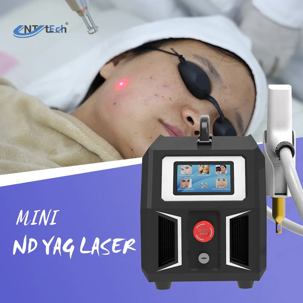 Máquina portátil de carbono para remoção de tatuagem, peeling a laser para nd yag, comutado q, remove a cor da tatuagem