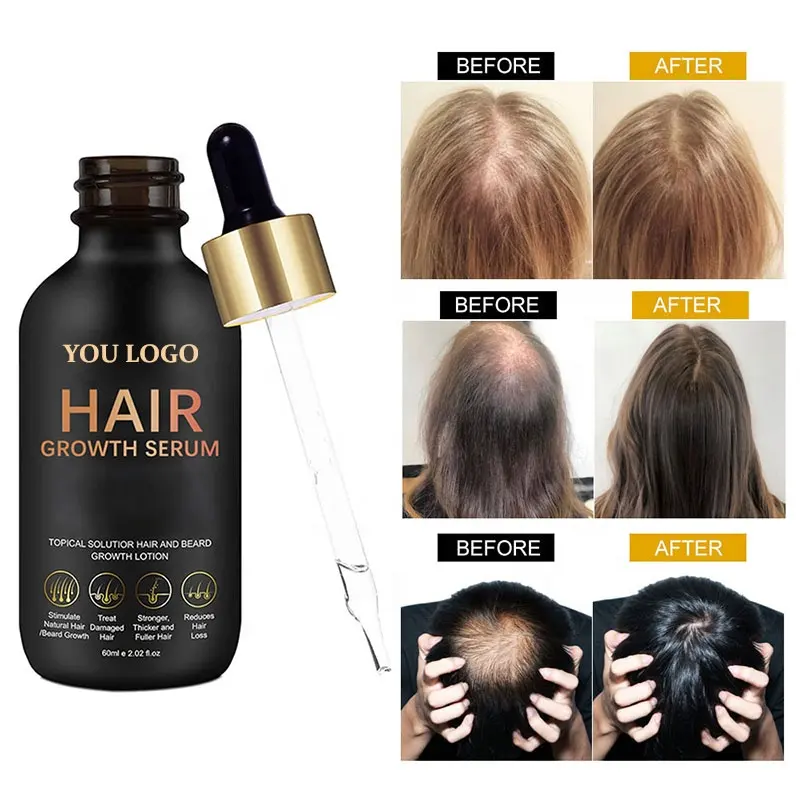 Заводская торговая марка, быстрорастущее масло для волос, биотин, сыворотка для роста волос, сияющая органическое эффективное эфирное масло против выпадения волос
