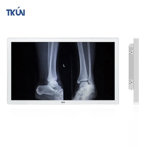 27-Inch Professional 4K Medical Display With SDI <strong>Input</strong> <strong>Output</strong> Anti-Glare White P270WUGA-SDI TKUN <strong>Monitor</strong> Doctor's Operating Room - Product Image 1