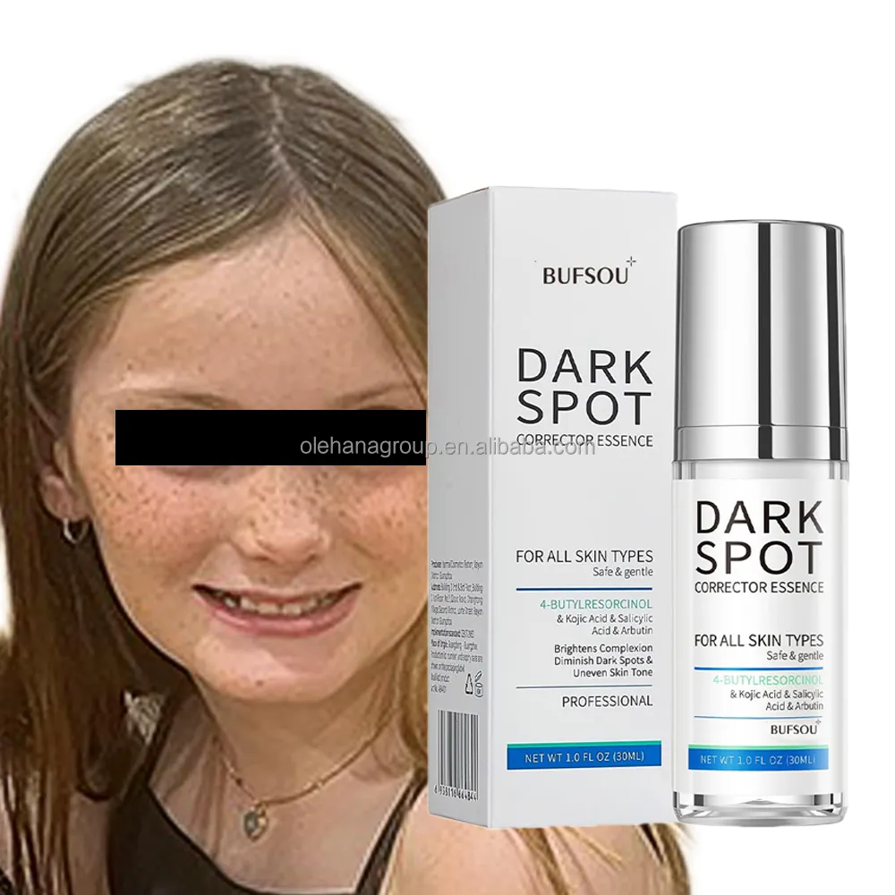 Private Label Jonge Meisje Sproet Gezicht Huidverzorging Verminderen Donkere Vlekken Whitening Crème En Spf Met Natuurlijke Organische Vitamine E