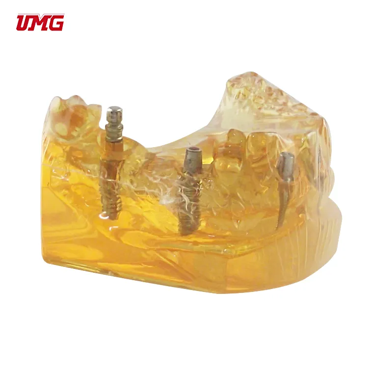 Modelo de placa odontológica transparente, modelo de dentes para estudo de ensino