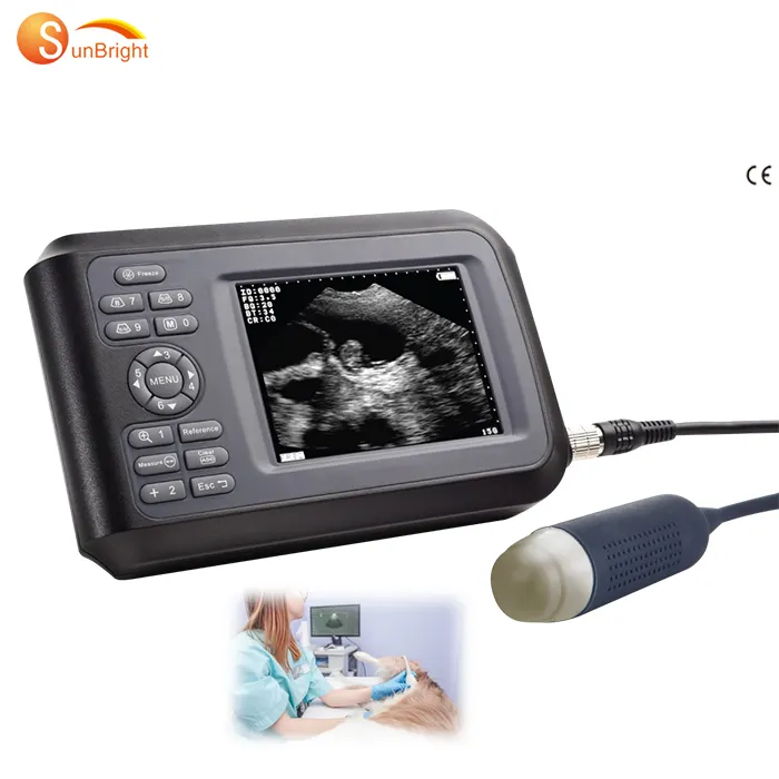 Medische 2d Draagbare Pw Cw Kleur Doppler Echografie Machine Prijs Kleur Doppler Echografie Scanner