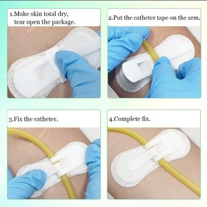 3*9cm Guidé <span class=keywords><strong>Suprapubic</strong></span> Medical <span class=keywords><strong>Supplies</strong></span> <span class=keywords><strong>Catheter</strong></span> Foley Holder <span class=keywords><strong>Catheter</strong></span> Bag Holder Iv Pole Combine Bag - Product Image 6