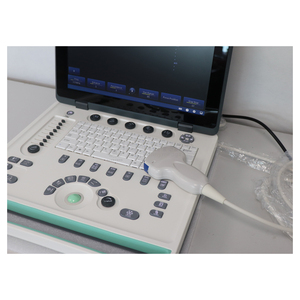 SY-A032-2 süper taşınabilir siyah ve beyaz kablosuz Wifi ultrason prob tarayıcı Doppler ultrason makinesi