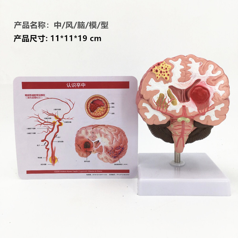 Pathological brain model