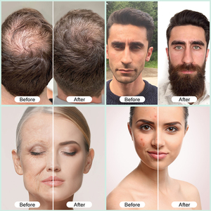 3 + 3 chuyên nghiệp Niacinamide làm sáng chăm sóc da vi hệ thống truyền pdrn tăng trưởng tóc Ampoule huyết thanh để sử dụng nhà - Product Image 5
