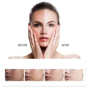 Özel etiket cilt beyazlatma glutatyon kapsül 5000mg E vitamini OEM beyazlatma hapları Pakistan - Product Image 3