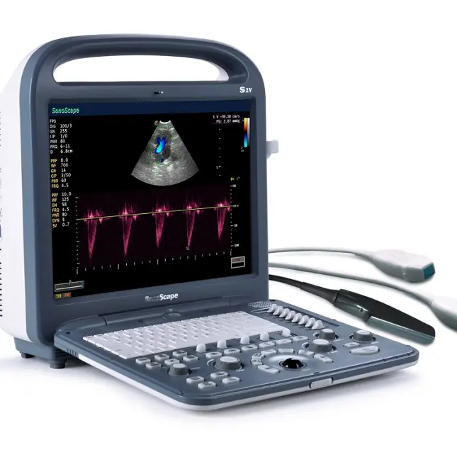 Ultrasuoni portatili 4D 5D a colori doppler Sonoscape S2 a colori