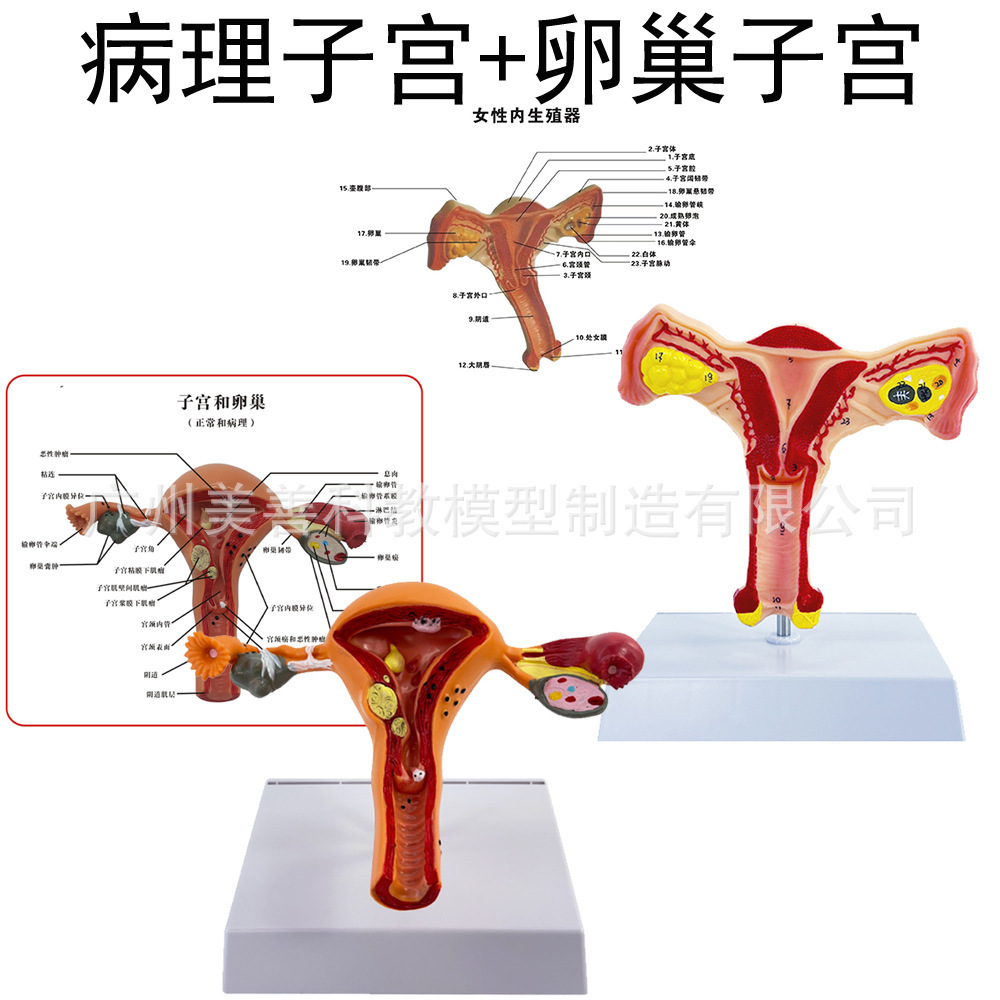 Pathologie de l'utérus et des ovaires