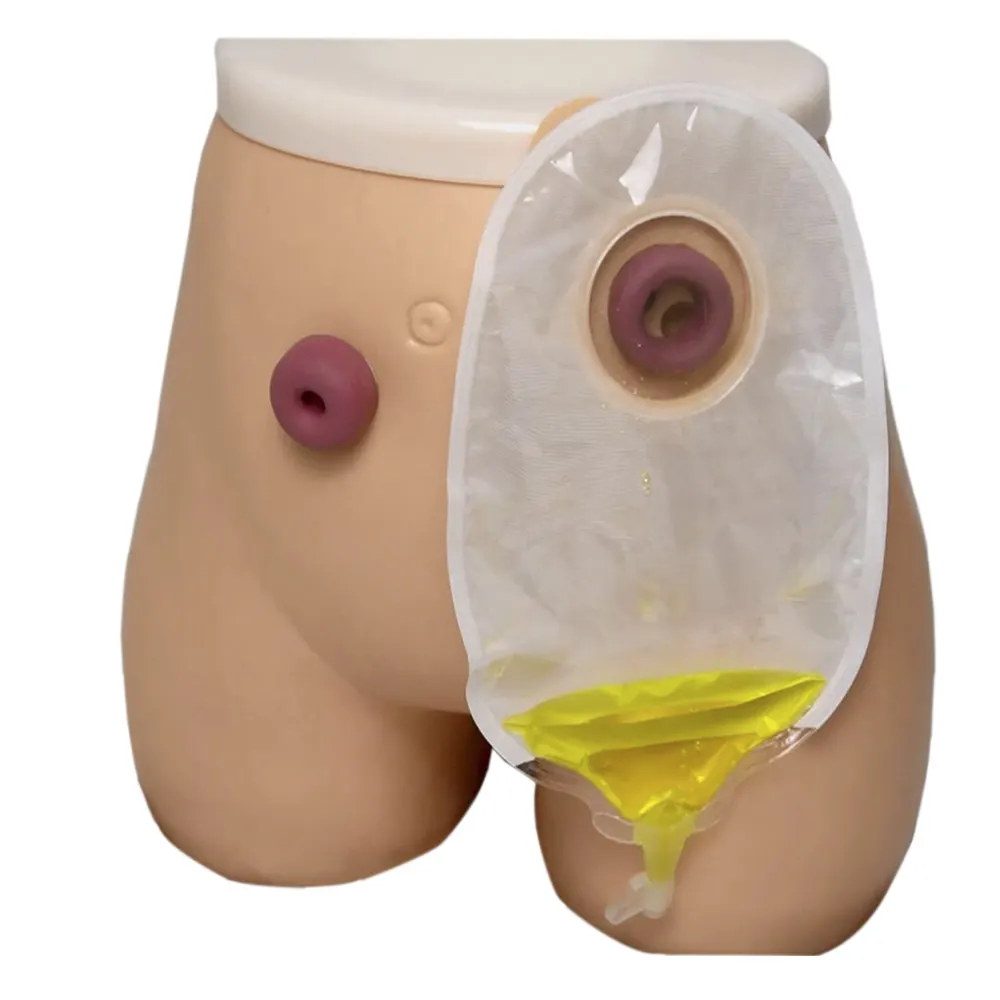 Bolsa de urostomía médica desechable One System