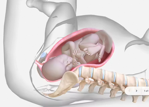 Virtual Anatomage Table 3D Sistema de anatomía humana Software y equipo para enseñar - Product Image 3