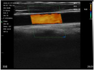 B26G Handheld Convex Cardiac Linear Ultrasound Device Wireless with Advanced Digital <strong>Imaging</strong> - Product Image 6