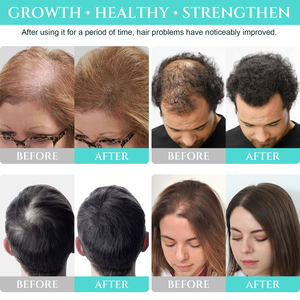 Olio per Capelli alle Erbe Indiane Adivasi 100mL, Prodotti Riparatori al Rosmarino, Oli per Capelli Danneggiati, Olio Essenziale per la Cura dei Capelli - Product Image 6