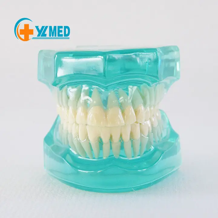 Modelo de diente odontología enseñanza modelo de diente de dentadura estándar azul o rosa dientes estables modelo dental estándar para enseñanza oral