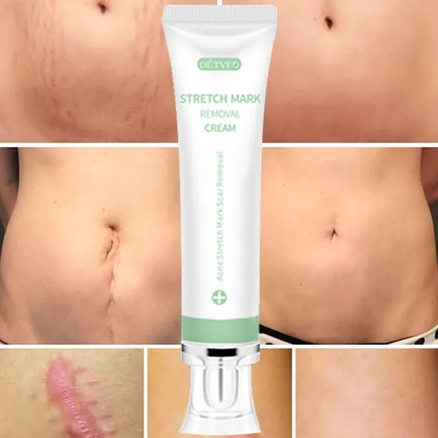 High Effective Skin Repairing Gel Natural Acne Pimple Mark Removing Stretch Marks Scar Removal Cream