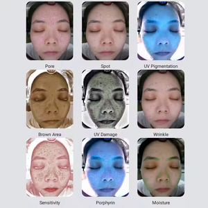 S.W <strong>Best</strong> Portable AI Beauty Machine <strong>Algorithm</strong> Skin Analyzer Device 3D Facial Scanner with Moisture Analysis for Home Use - Product Image 5