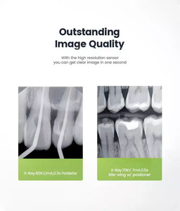 30% Offer Dental <strong>X</strong> Ray Machine With Rvg Sensor From DYNAMIC Manufacturer for <strong>Restoration</strong> - Product Image 5