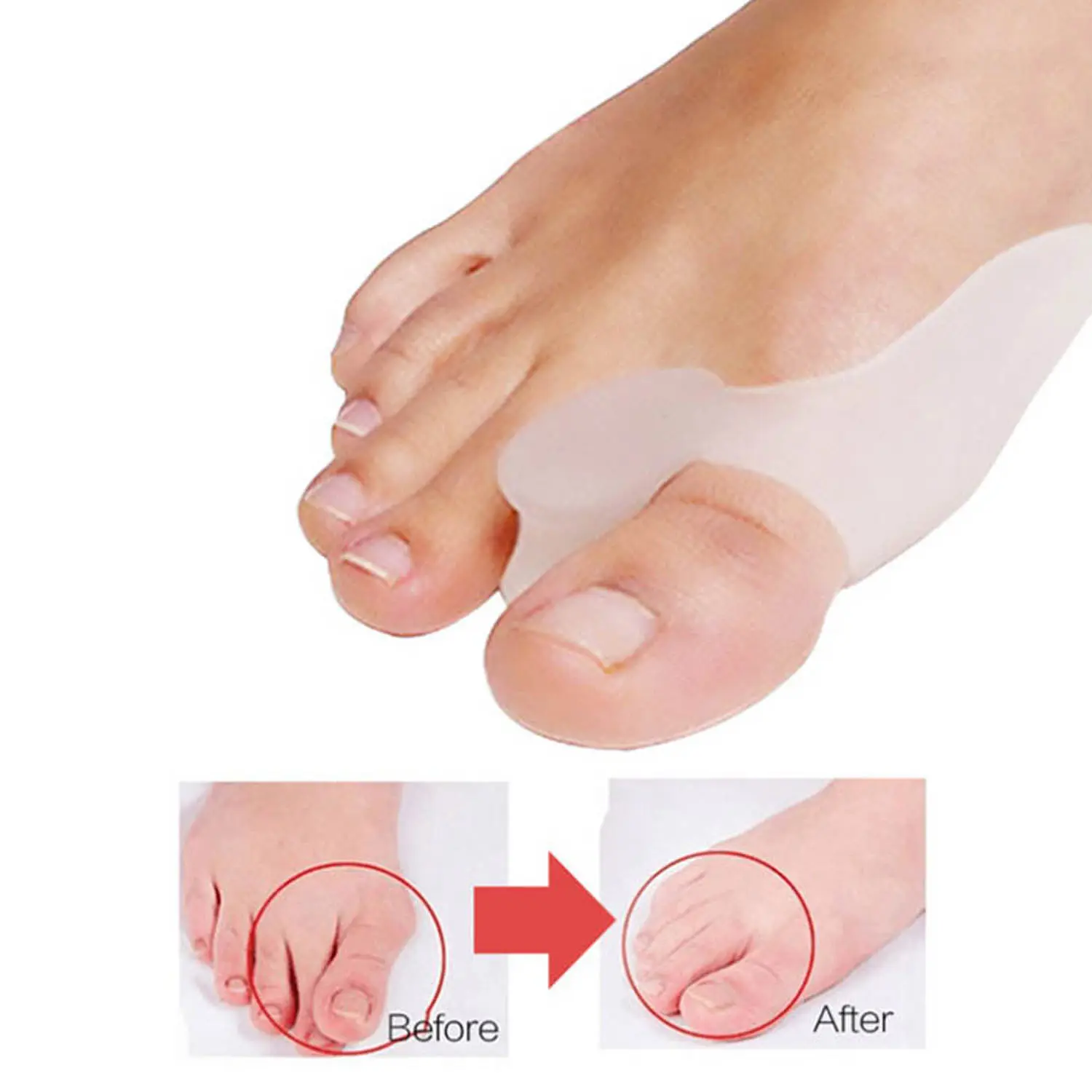 Gel Bunion Thumb Valgus Appliance Lindert Hallux Valgus Fuß schmerzen und beruhigt schmerzende Ballen