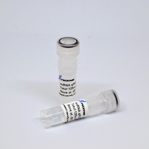 Tinzyme MiRNA QPCR test kiti, belirli etiketli probları sentezlemeye gerek kalmadan farklı hedef dizileri tespit ediyor. - Product Image 4