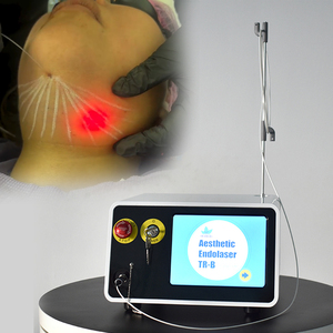 Sợi Laser lipolysis Laser máy hút mỡ 980nm 1470 NM y tế sợi Laser endolaser canula - Product Image 1