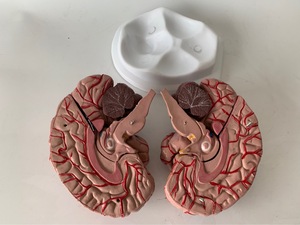 Farb codiertes Gehirn modell mit Arterien und Schädel nerven Anatomisches Lehrmittel für Neurologie und medizinische Kommunikation - Product Image 3