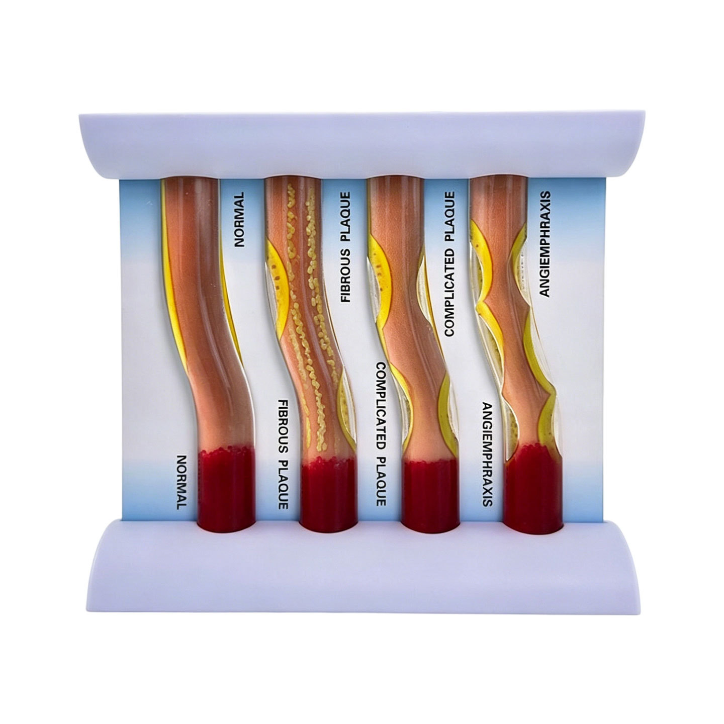 Four-Limb Dynamic Vascular Occlusion Model - English Version