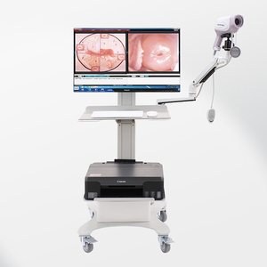 Cámara de colposcopia de ginecología con fuente de luz LED Kernel 3,27 millones de píxeles CCD Video Colposcope precio - Product Image 1