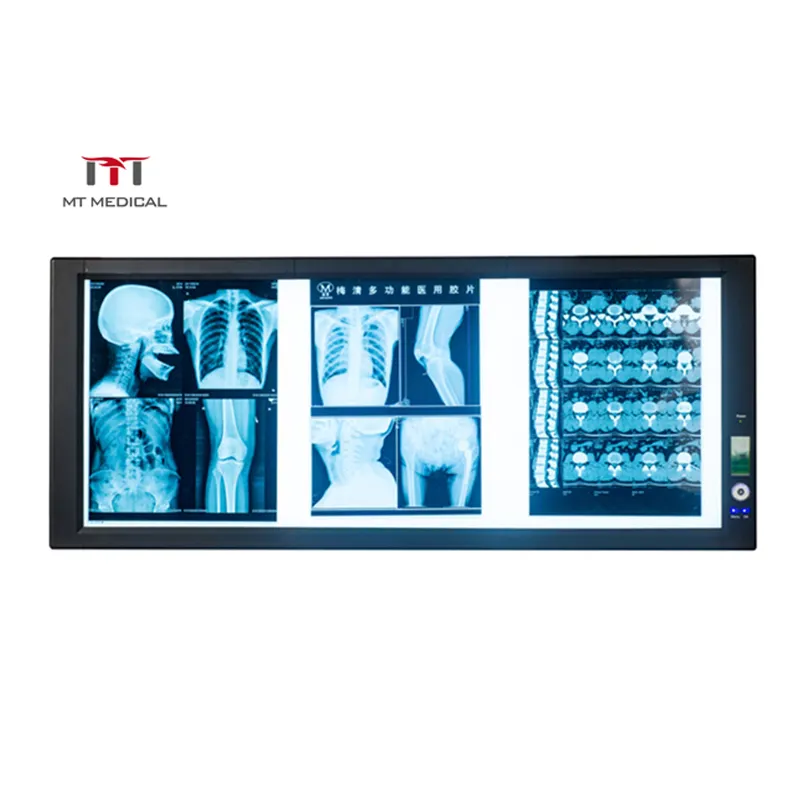 Больничный цифровой дисплей, стоматологический нематоскоп, светодиодный двойной рентгеновский медицинский просмотр пленки