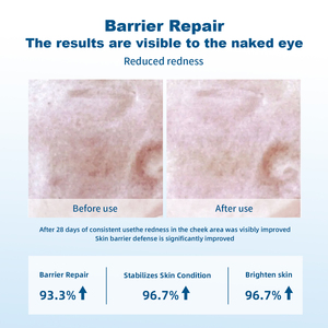 Güç tamir gözenek küçülen Serum onarım skar akne uticeuticals Recombinant insanlaşmış tip III kollajen jel Serum soyunma - Product Image 5