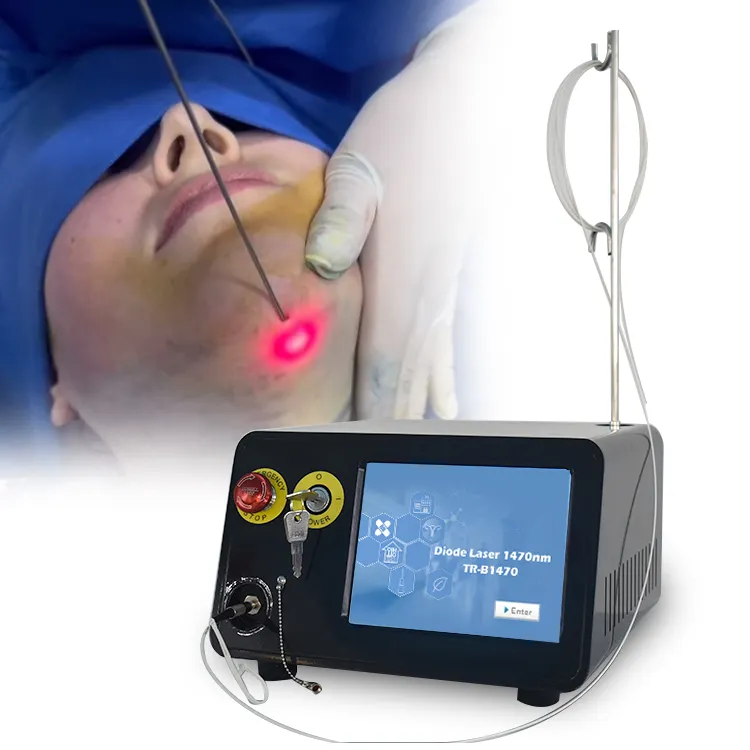 1064nm Laser hút mỡ máy endolaser 980 kép 1470nm Diode máy laser