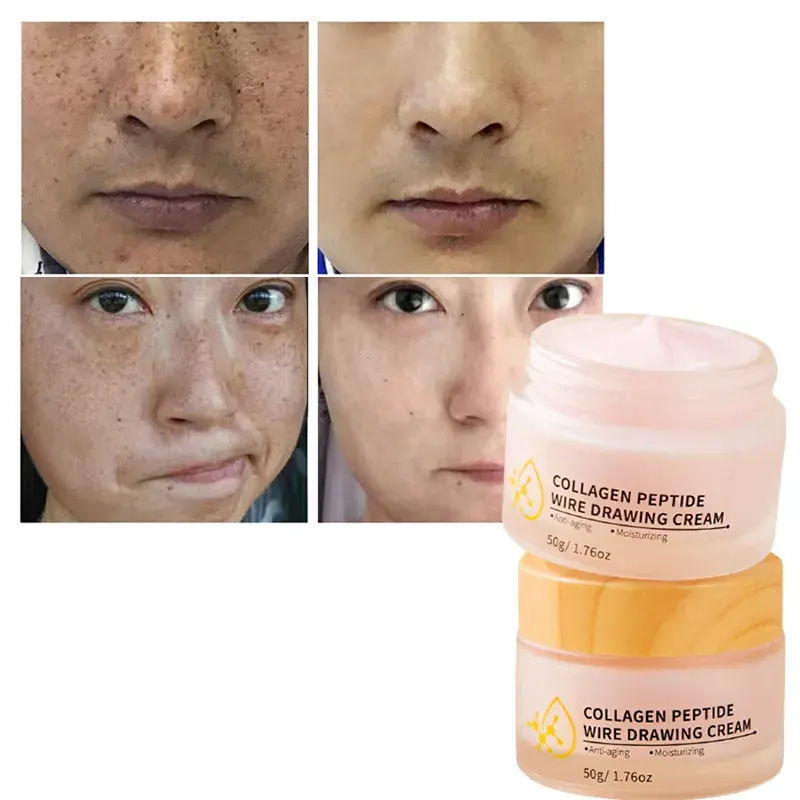 OEM Anti Envejecimiento Leche Hidratante Colágeno Tonal Blanqueamiento Día Noche Péptido Cara Cuerpo Melasma Removedor Alambre Dibujo Crema