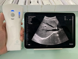 B26F <strong>the</strong> Highest 64 Channel 3 in 1 Handheld Wireless and Wired Color Doppler Ultrasound Scanner Probe for Windows IOS Android - Product Image 4