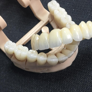 Biểu Tượng Tùy Chỉnh Chất Lượng Tốt Nha Khoa Sản Phẩm Phòng Thí Nghiệm Hàng Tiêu Dùng Zirconia Nha Khoa CAD Cam Giá 4D Cộng Với Multilayer Nha Khoa Zirconia Khối - Product Image 6