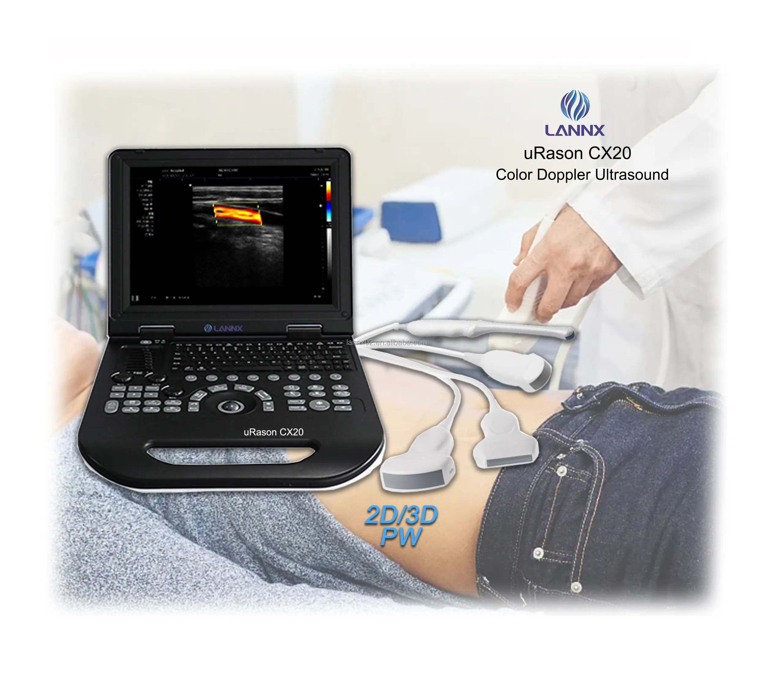 LANNX uRason CX20 Hot offerta 2D/3D PW Scanner a ultrasuoni Doppler ecografo portatil cardioecocardiografia macchina