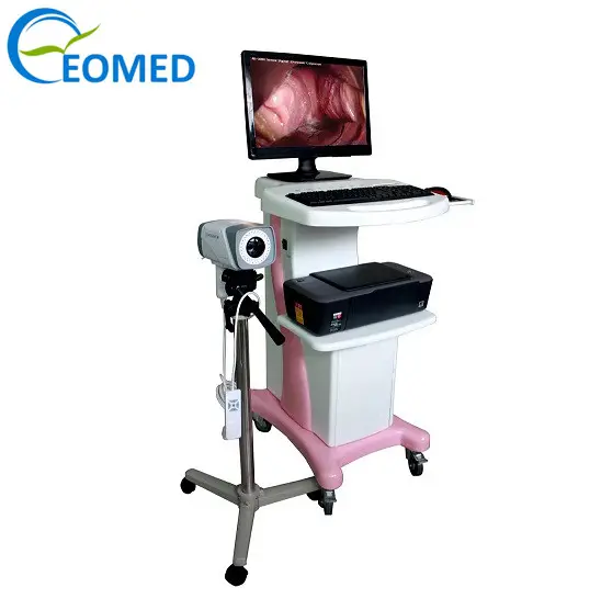 Hoge Kwaliteit Hot Selling Digitale Video Elektronische Colposcoop Voor Gynaecologische Onderzoek DVC5003