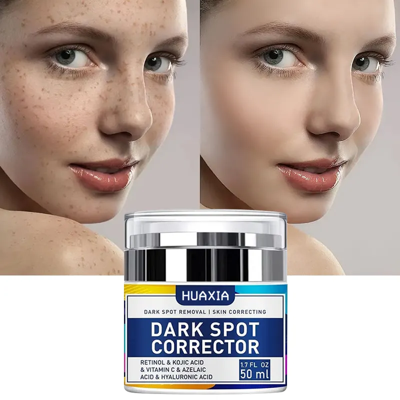 Corrector de manchas oscuras OEM/ODM, crema para eliminar pecas de etiqueta privada, bajo pedido mínimo, crema antipecas, crema para manchas oscuras