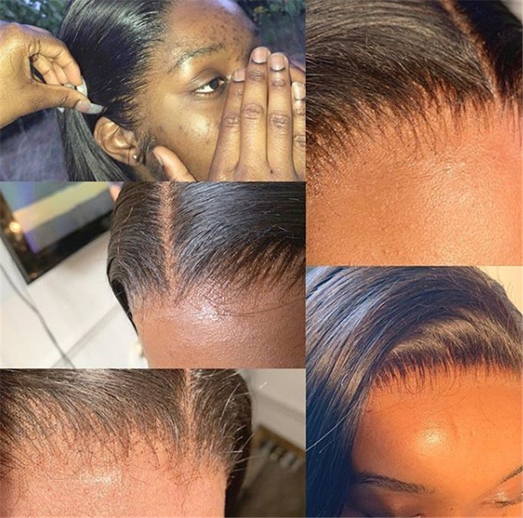 Frontal & Closure