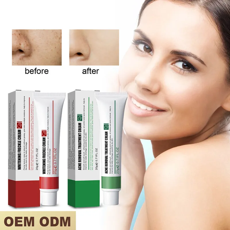 Private Label Pimples Melasma Blemish Removal Cream Strong Bleaching Whitening Face Dark Spot Remover Cream