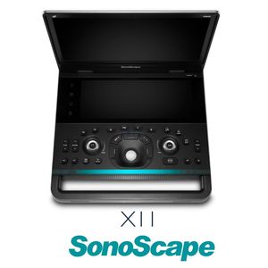 SONOScape X11ラップトップポータブル超音波3d 4dカラードップラーOB GYN病院人間用超音波用最新デザイン