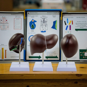 Anatomi öğretim ve klinik eğitim için PVC insan karaciğer Organ modeli Normal tıbbi simülasyon - Product Image 5