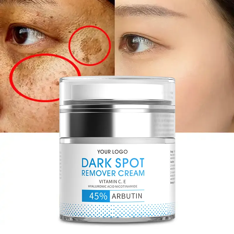 Crema facial blanqueadora antienvejecimiento hidratante para manchas oscuras de piel de marca blanca como la nieve marca blanca de fábrica OEM