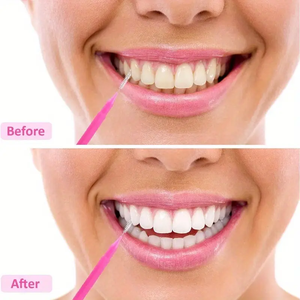 Cepillo Interdental con Forma de Lápiz Tipo I, Palillos Dentales Personalizados, Cepillos Interdentales de Limpieza Profunda para Ortodoncia - Product Image 6